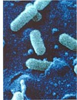 Listeria-Bakterien heften sich an die Darmschleimhaut (im Elektronenmikroskop beobachtet). 